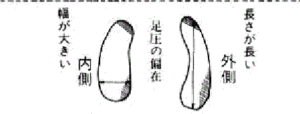 足圧　足の大きさの差　足の長さの差　足の形が左右違う　西荻窪整体