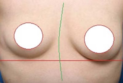 胸の高さが違う　胸の大きさが違う　体の歪み　目の大きさが違う　西荻窪整体