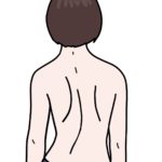 突発性側弯症　側弯症　礒谷式力学療法　西荻窪整体