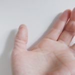 手の荒れ　ひび　あかぎれ　しもやけ　礒谷式力学療法　西荻窪整体