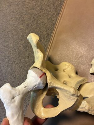 股関節を正面から見たところ