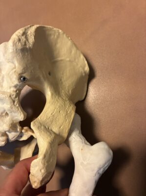 股関節を後ろから見たところ