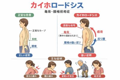 カイホロードシスを図示したイラスト