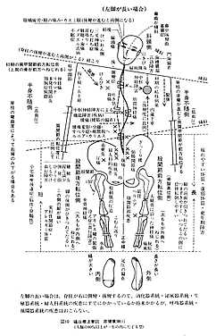 礒谷式力学療法